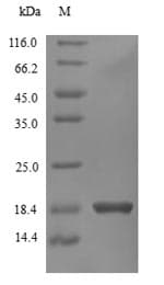 Human IFN Gamma / Interferon Gamma Protein (Recombinant 6His, N-terminus)