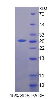 Human c-Src Kinase / CSK Protein (Recombinant His-T7)