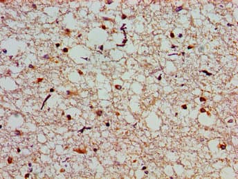SLC25A12 / ARALAR Antibody