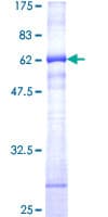 Human CD38 Protein (Recombinant GST)
