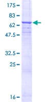 Human CD46 Protein (Recombinant GST)