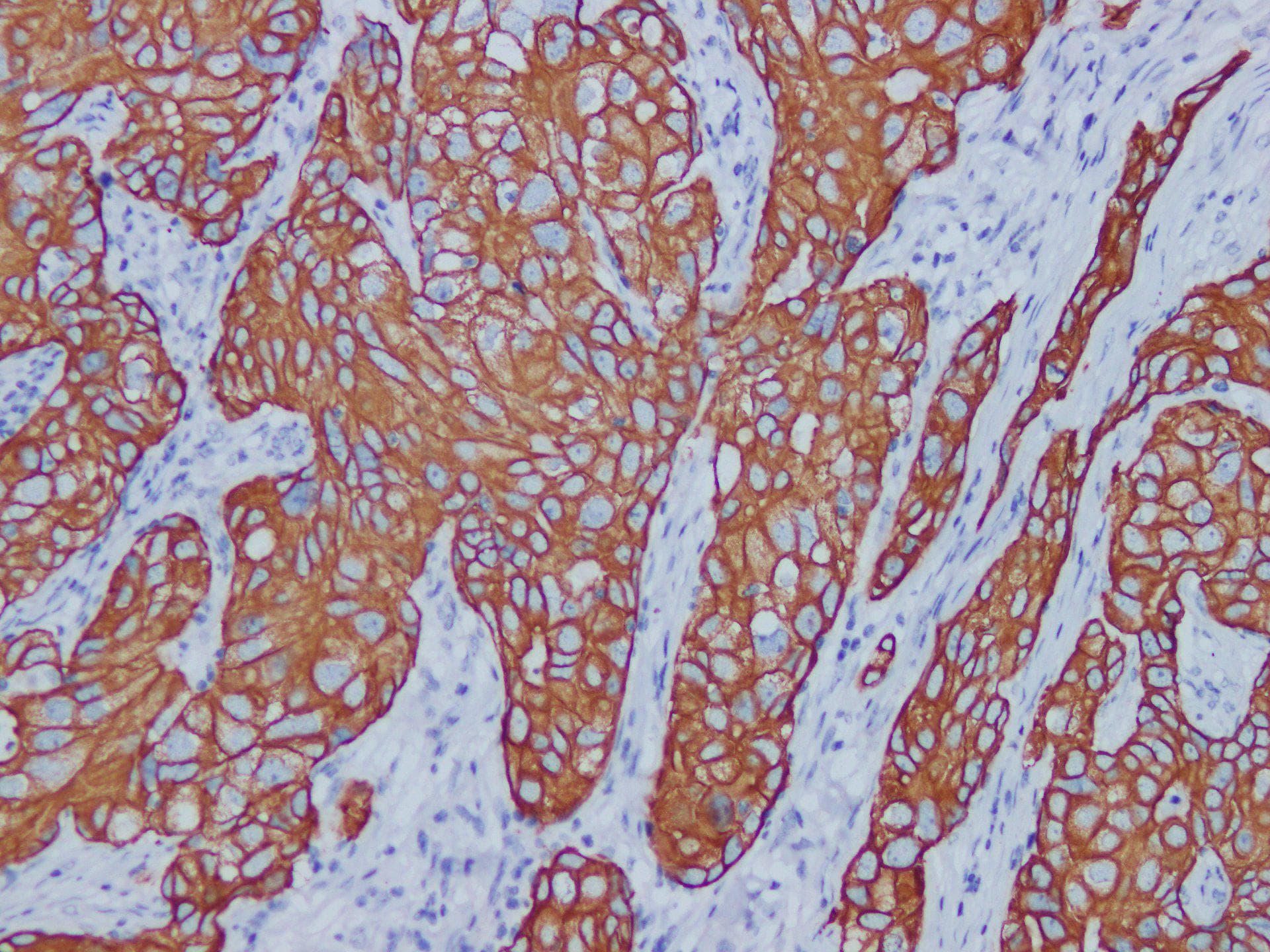 KRT7 / CK7 / Cytokeratin 7 Antibody