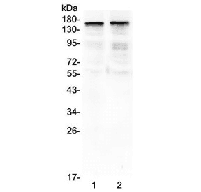 Polyclonal Rabbit anti-Human THBS2 / Thrombospondin 2 Antibody (WB)