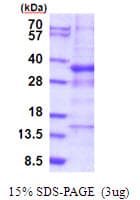 Human GTF3C6 Protein (Recombinant His)