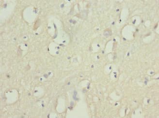 Polyclonal Rabbit anti-Human FASTK / FAST Antibody (IHC)