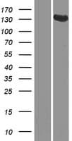 Human GUCY2D Protein (Over-Expression Lysate Myc-DDK (Flag))