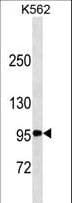 CD30 Antibody (aa294-321)