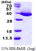 E. coli MDH / Malate Dehydrogenase Protein (Recombinant His)