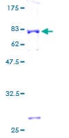 Human ACY1 / Aminoacylase 1 Protein (Recombinant GST)