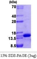 Human VEGFA / VEGF Protein (Recombinant)