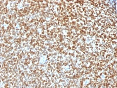 NKX2-2 Antibody (clone NX2/1422R, Azide-free, Carrier-free)