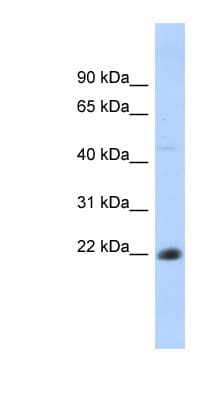 CD40 Antibody (aa35-84)
