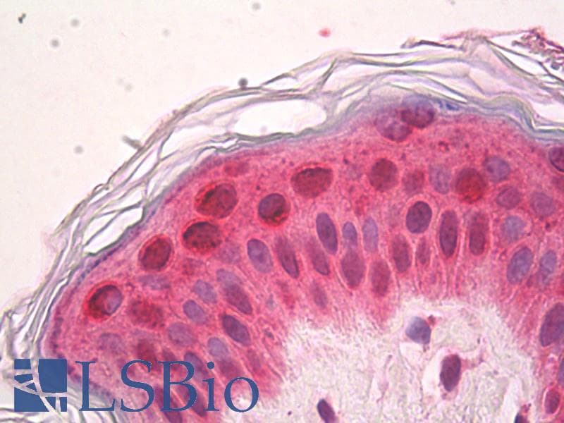 IHC-plus™ Monoclonal Mouse anti-Human SETD7 / SET7 Antibody (clone 5B4, IHC, IF, WB)