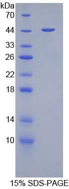 Mouse GFAP Protein (Recombinant His-GST)