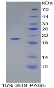 Mouse LAMB3 / Laminin Beta 3 Protein (Recombinant His-T7)