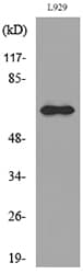 Polyclonal Rabbit anti-Human IL2RB / CD122 Antibody (WB)