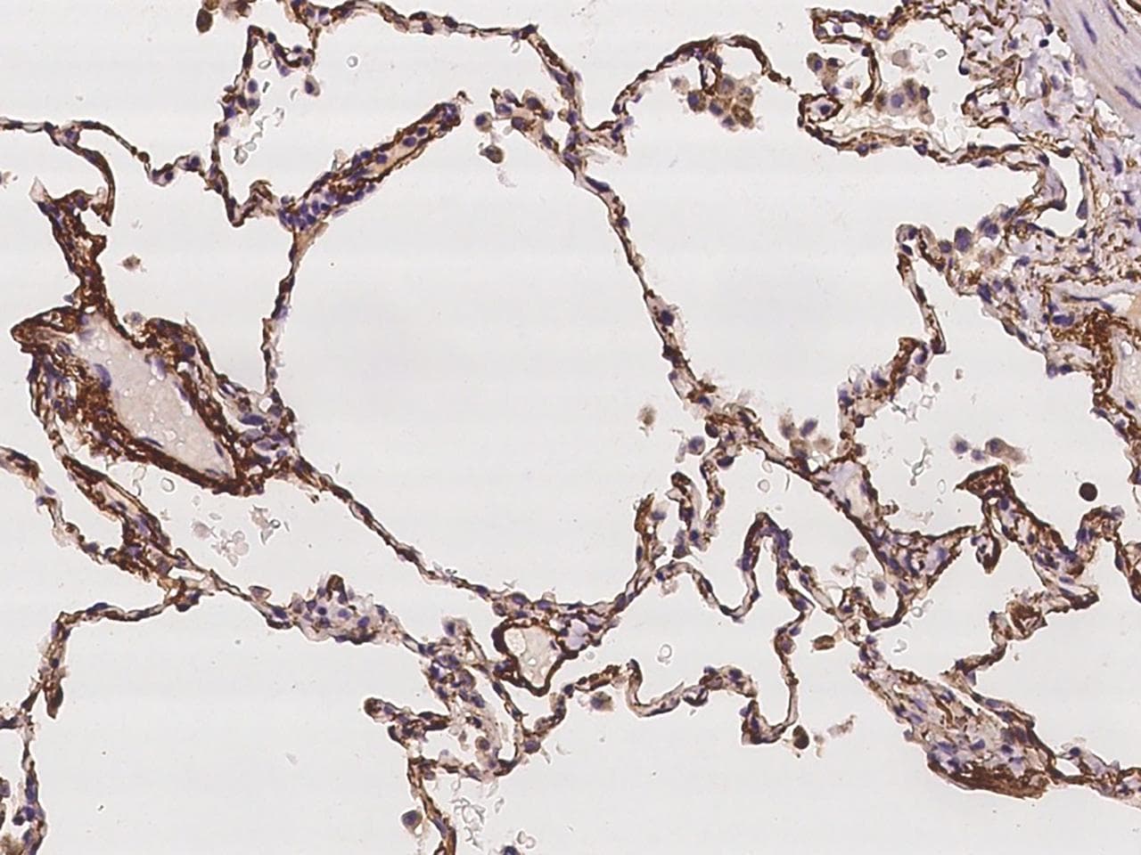 COL8A1 / Collagen VIII Alpha 1 Antibody