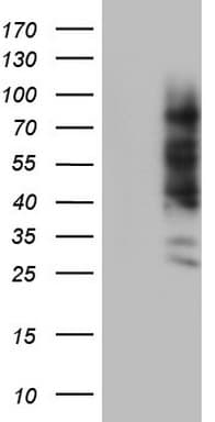 Monoclonal Mouse anti-Human CEACAM5 / CD66e Antibody (clone OTI5F2, aa35-680, IHC, WB)