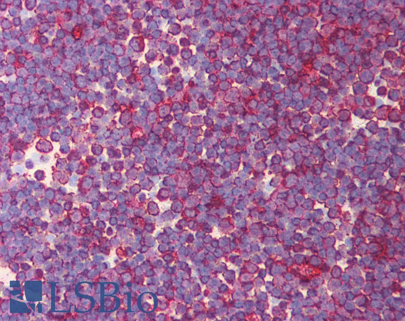 Polyclonal Rabbit anti-Human Eomesodermin / EOMES Antibody (N-Terminus, IHC, WB)