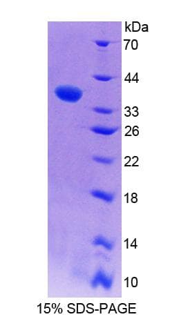Mouse Band 4.1 / EPB41 Protein (Recombinant His-T7)