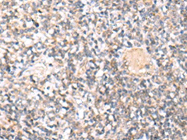Polyclonal Rabbit anti-Human IL36A Antibody (IHC, WB)