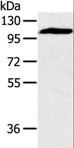 Polyclonal Rabbit anti-Human PYGM Antibody (IHC, WB)
