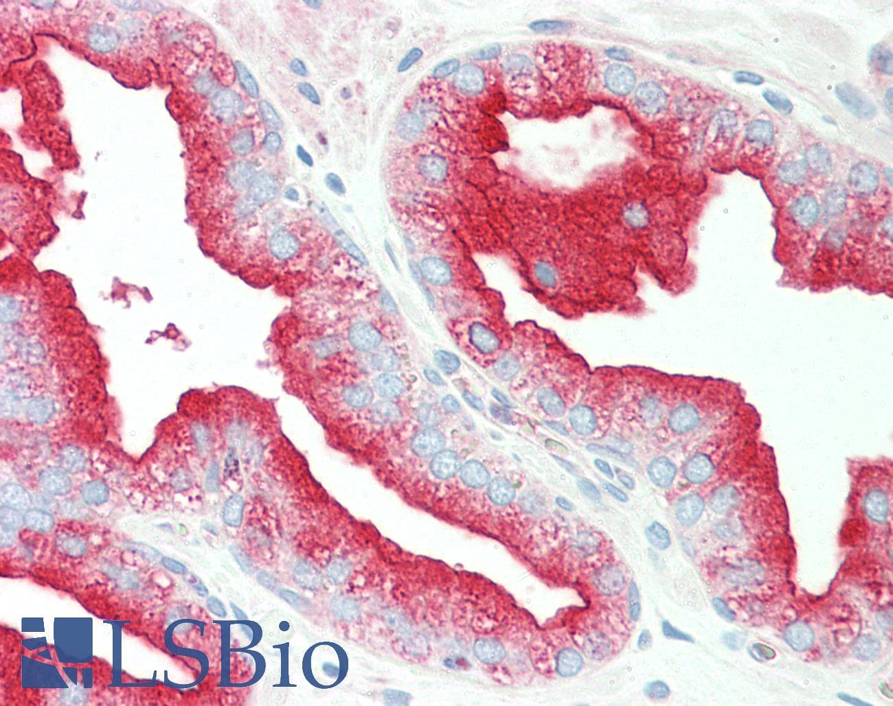 IHC-plus™ TMBIM1 Antibody