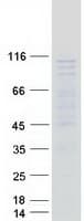 Human C1orf107 / DEF Protein (Recombinant Myc-DDK (Flag))
