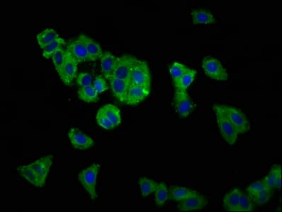 SLC12A5 / KCC2 Antibody