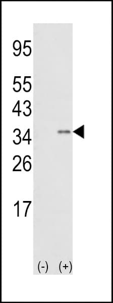 Polyclonal Rabbit anti-Human SNAI1 / SNAIL-1 Antibody (aa9-39, IHC, WB)