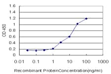 Monoclonal Mouse anti-Human SLC25A6 / ANT3 Antibody (clone 2A9, WB)