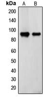 TGM2 / Transglutaminase 2 Antibody (N-Terminus)