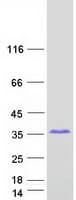 Human SPAG16 Protein (Recombinant Myc-DDK (Flag))