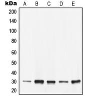 YWHAE / 14-3-3 Epsilon Antibody (C-Terminus)