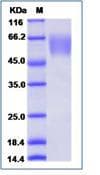 Mouse CD47 Protein (Recombinant Rabbit IgG Fc, C-terminus)