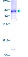 Human PDHA1 / PDH E1 Alpha Protein (Recombinant GST)