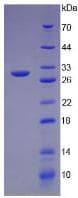 Human ITLN1 / Omentin Protein (Recombinant His, N-Terminal)