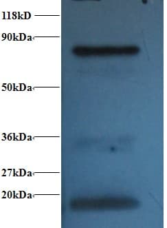 Hemoglobin Antibody (Biotin)