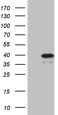 VGLL1 Antibody (clone OTI6E1)