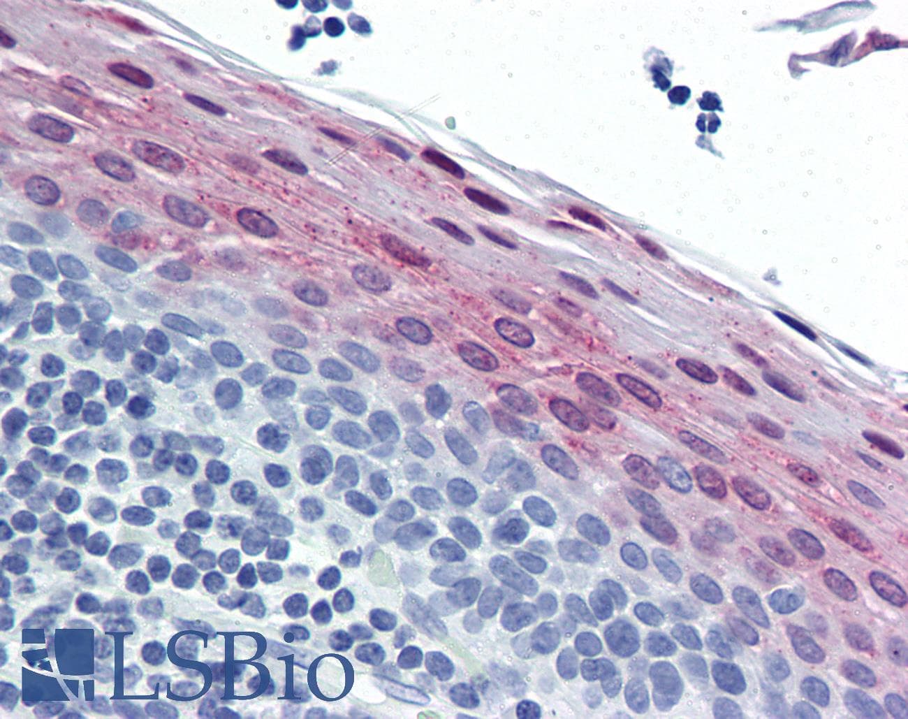 IHC-plus™ CSTB / Cystatin B / Stefin B Antibody (clone M2F1)