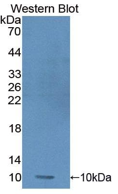 PRM1 / Protamine 1 Antibody (aa2-51)