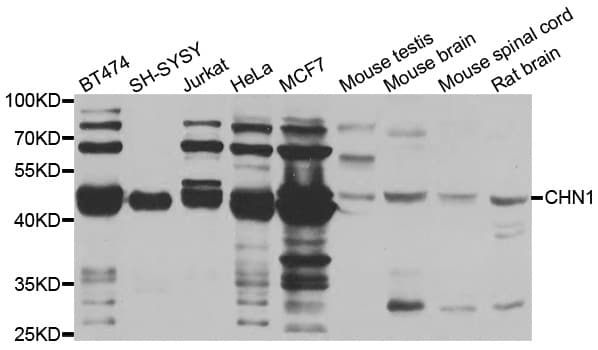 CHN1 Antibody