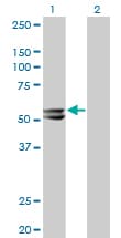 HMGCS2 / HMG-CoA Synthase 2 Antibody (clone 1E9)