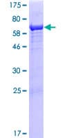 Human IKBIP Protein (Recombinant GST)