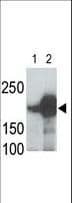 Polyclonal Rabbit anti-Human LRP5 Antibody (aa1538-1567, IHC, WB)
