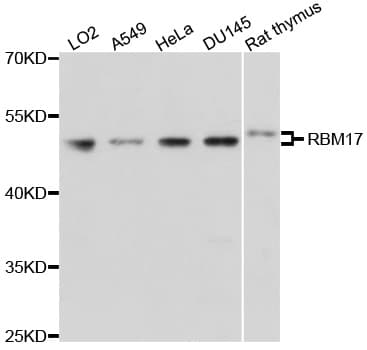 RBM17 Antibody