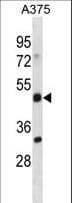 Polyclonal Rabbit anti-Human ADRM1 Antibody (aa368-397, WB)