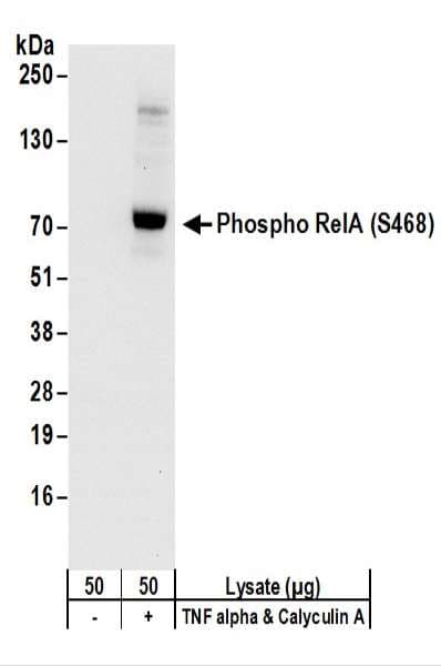 RELA / NFKB p65 Antibody (phospho-Ser468)