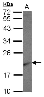 RPL26 / Ribosomal Protein L26 Antibody