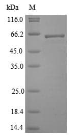 Lassa Virus Lassa N Protein (Recombinant)